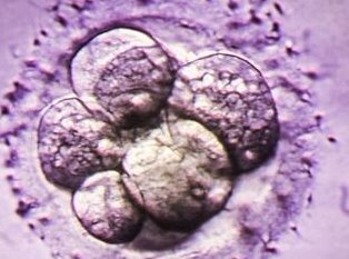 死精率80%的男性可以在海城市做三代试管吗？公开2026做三代试管条件