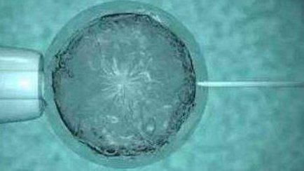 试管婴儿手术真的靠谱吗？做试管婴儿有后遗症吗？做试管中促排治疗会导致卵巢衰老吗？